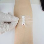 Sutura Adhesiva Reemplazo Puntos Para Corte Profundo 1un - Imagen 5