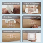 Sutura Adhesiva Reemplazo Puntos Para Corte Profundo 1un - Imagen 4
